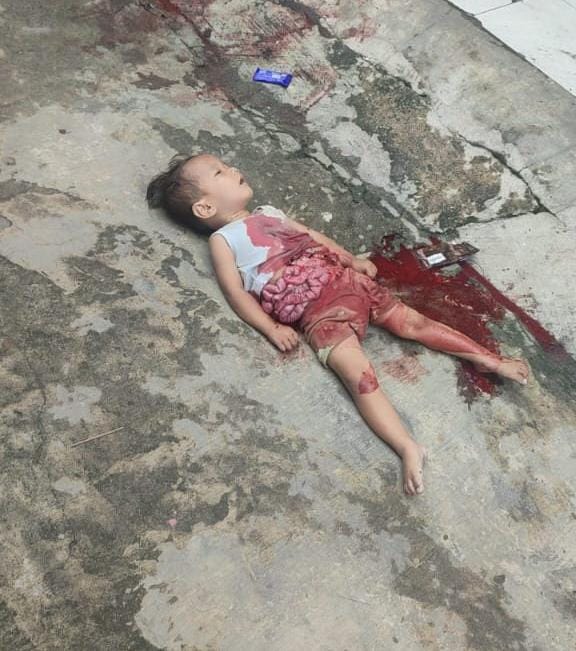Salah seorang bocah berlumuran darah tampak tergeletak tidak sadarkan diri.