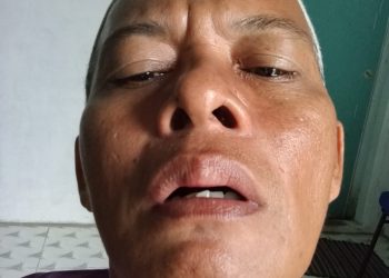 Ustadz Muslim Istiqomah Dikeroyok Brutal di Kota Tebing Tinggi, APH Diminta Usut Tuntas dan Sikat Judi Sabung Ayam!
