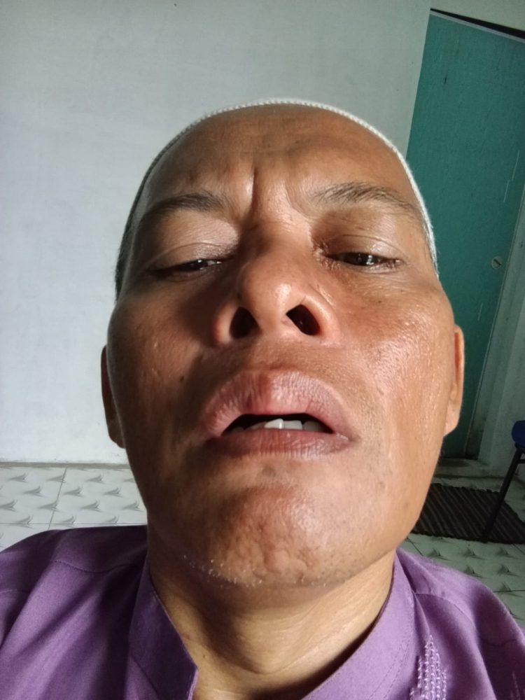 Ustadz Muslim Istiqomah, SSQ, C.TP bersama rekannya Muhammad Yusuf menjadi korban pengeroyokan para Premen, Minggu ( 7/6/2026 ) di Kota Tebing Tinggi.